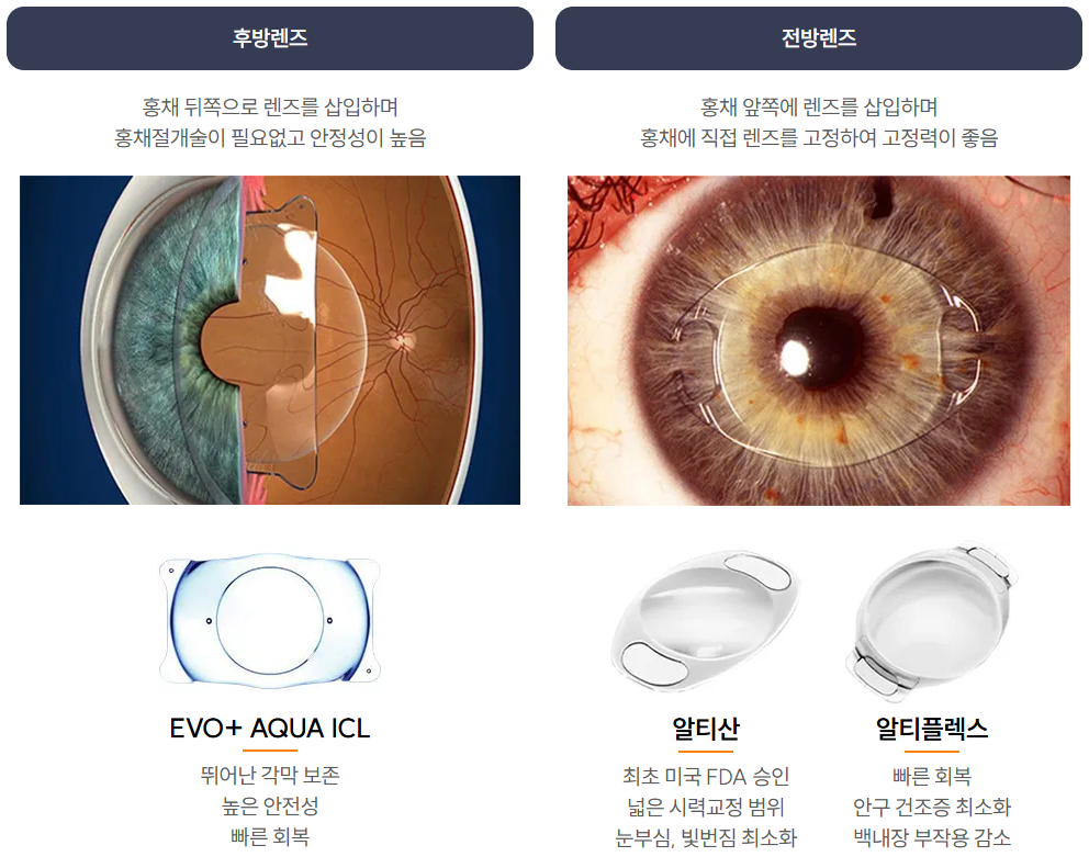 렌즈삽입술 종류가 전방과 후방이 있다는 내용과 전후방 렌즈 종류를 설명하는 이미지