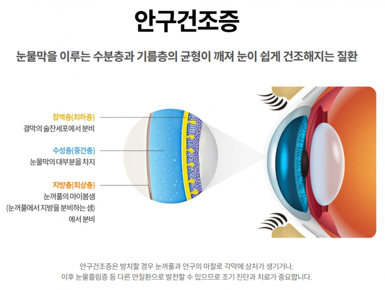 눈물이자꾸흐를때, 단순 문제일까? 원인부터 구분해봅니다