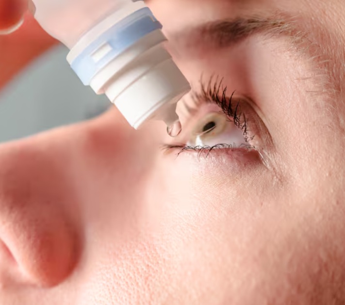 눈이붓는원인을 해결하기 위해 안약을 넣는 모습