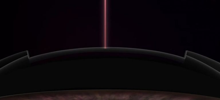 라섹일주일후 시력 어느 정도일까? 회복 상태와 주의해야 할 증상