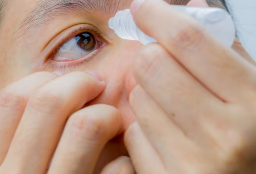 라식후관리를 위해 꾸준히 인공눈물을 넣는 여자