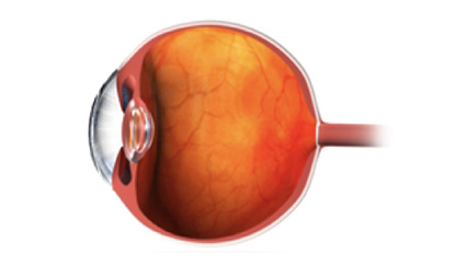 정상 유리체 이미지