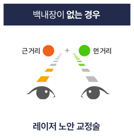 레이저 노안 교정술: 백내장이 없는 경우 레이저 노안 교정술 안내 이미지 — 근거리와 원거리를 동시에 교정해 노안을 개선하는 레이저 시력교정 수술 방법을 설명함.