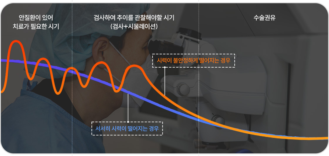 시력 변화 추이 그래프 이미지 — 서서히 시력이 저하되는 경우와 불안정하게 급격히 떨어지는 경우를 비교해, 검사 및 시뮬레이션 시기와 수술 권유 시점을 설명함.