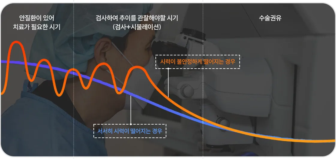 시력 변화 추이 그래프 이미지 — 서서히 시력이 저하되는 경우와 불안정하게 급격히 떨어지는 경우를 비교해, 검사 및 시뮬레이션 시기와 수술 권유 시점을 설명함.