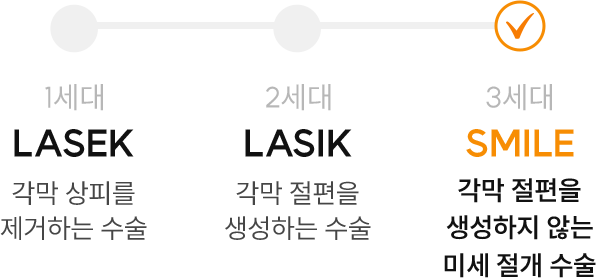 라섹·라식·스마일 수술 비교 인포그래픽 — 1세대 라섹은 각막 상피를 제거, 2세대 라식은 각막 절편을 생성, 3세대 스마일은 절편을 생성하지 않는 미세 절개 수술을 의미함.