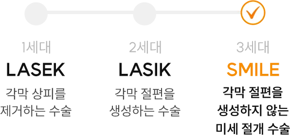 라섹·라식·스마일 수술 비교 인포그래픽 — 1세대 라섹은 각막 상피를 제거, 2세대 라식은 각막 절편을 생성, 3세대 스마일은 절편을 생성하지 않는 미세 절개 수술을 의미함.