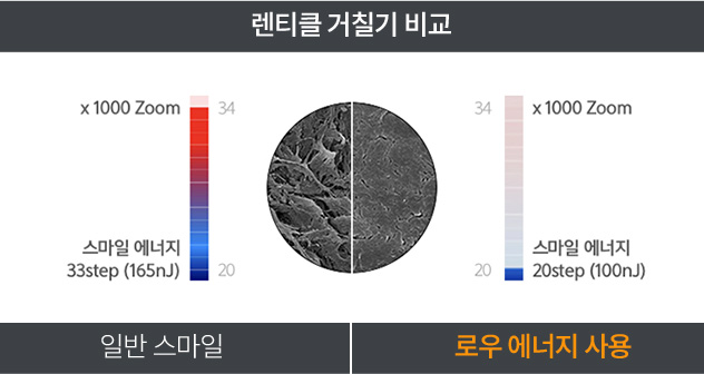 스마일라식 렌티클 거칠기 비교 이미지 — 일반 스마일 수술 대비 로우 에너지(100nJ, 20step) 사용 시 각막 절단면이 매끄럽고 조직 손상이 적은 것을 보여줌.