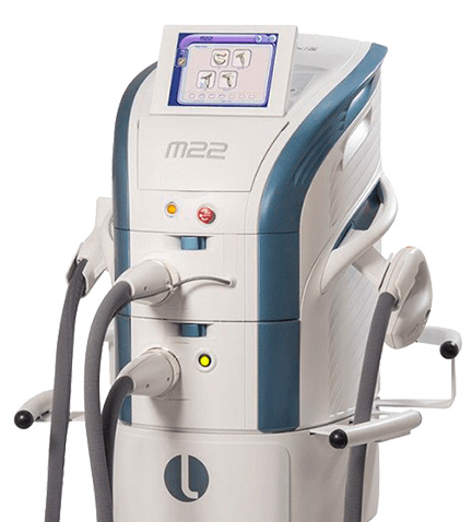 lumenis m22 IPL레이저 치료 장비 이미지
