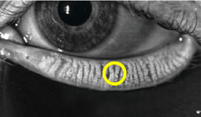 정상 마이봄샘 이미지