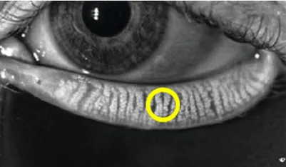 정상 마이봄샘 이미지