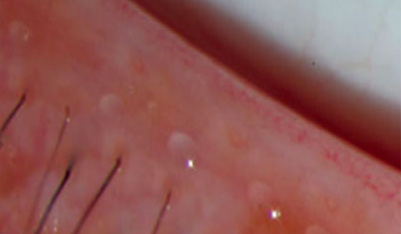 깨끗하고 맑은 기름샘 이미지