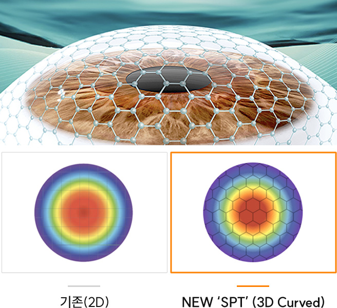SPT 기술 비교 이미지 — 기존 2D 레이저보다 3D 곡면(3D Curved) 방식의 NEW SPT가 각막 곡률에 정밀하게 맞춰 더 균일하고 매끄러운 절삭면을 구현함.